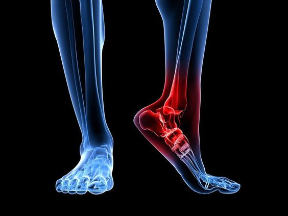 Tendon Repair Surgery: Recovery Tips