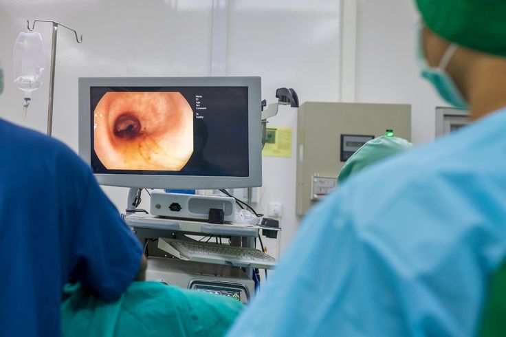 The Importance of Colonoscopies for Preventative Health