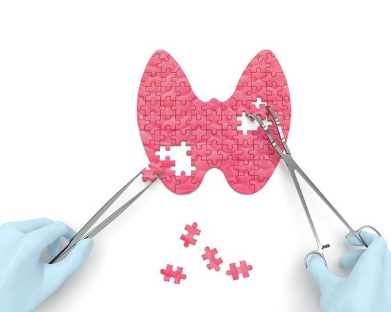 Thyroid Surgery: What to Expect