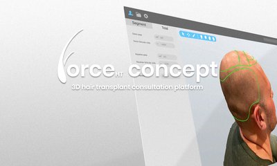 ForceHT-Concept-Banner