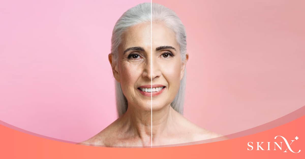 หน้ามีริ้วรอยทำไงดี