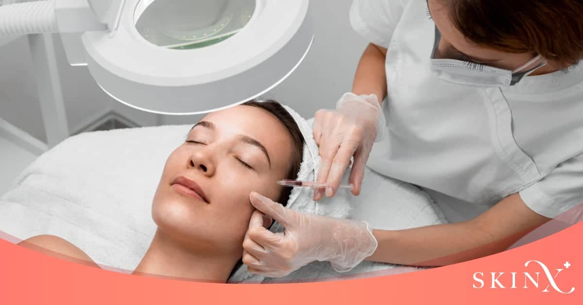 ฟิลเลอร์ขมับ