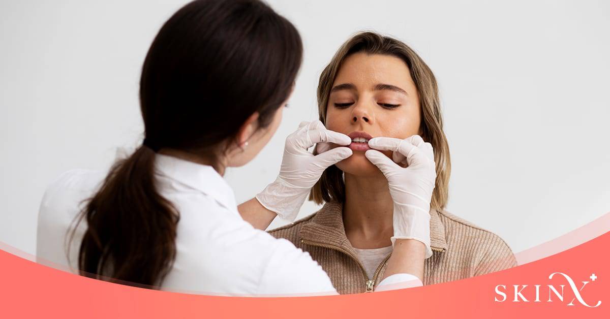 คำแนะนำก่อนฟิลเลอร์