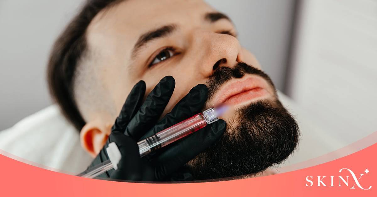 ฉีดฟิลเลอร์ปากผู้ชาย