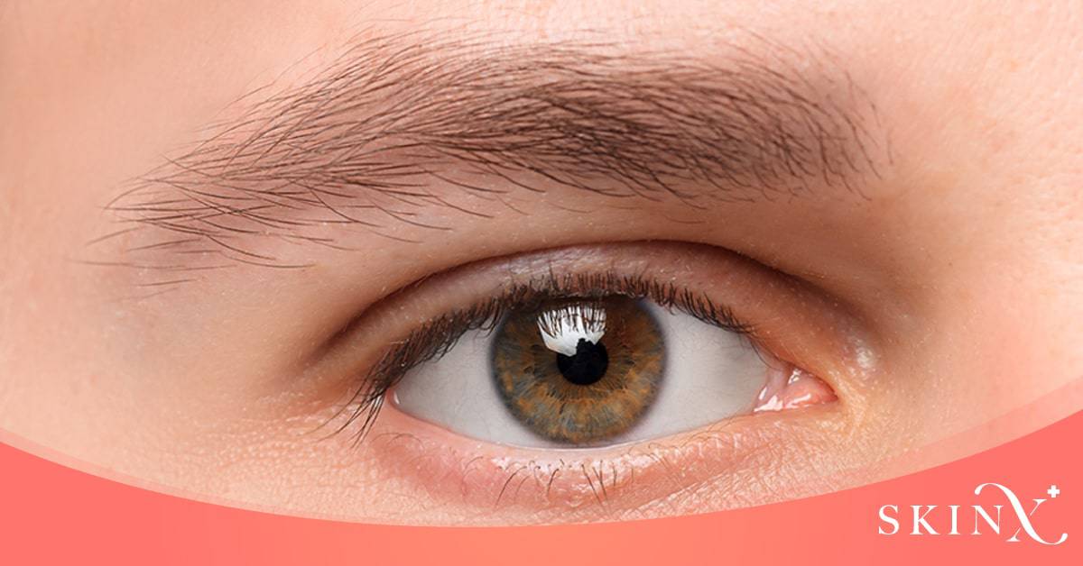 ดอลลี่อายคือ