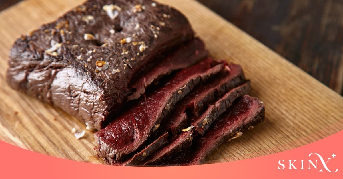 หลังฉีดฟิลเลอร์ห้ามอะไรบ้าง