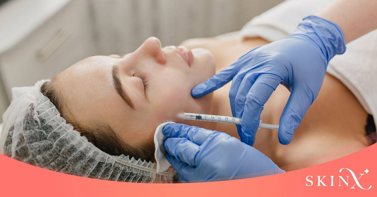 โบท็อกริ้วรอย