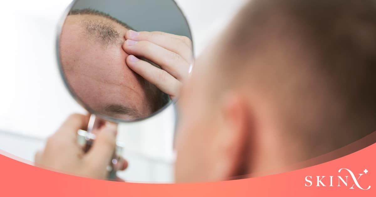 ข้อดีของการทำ PRP ผม