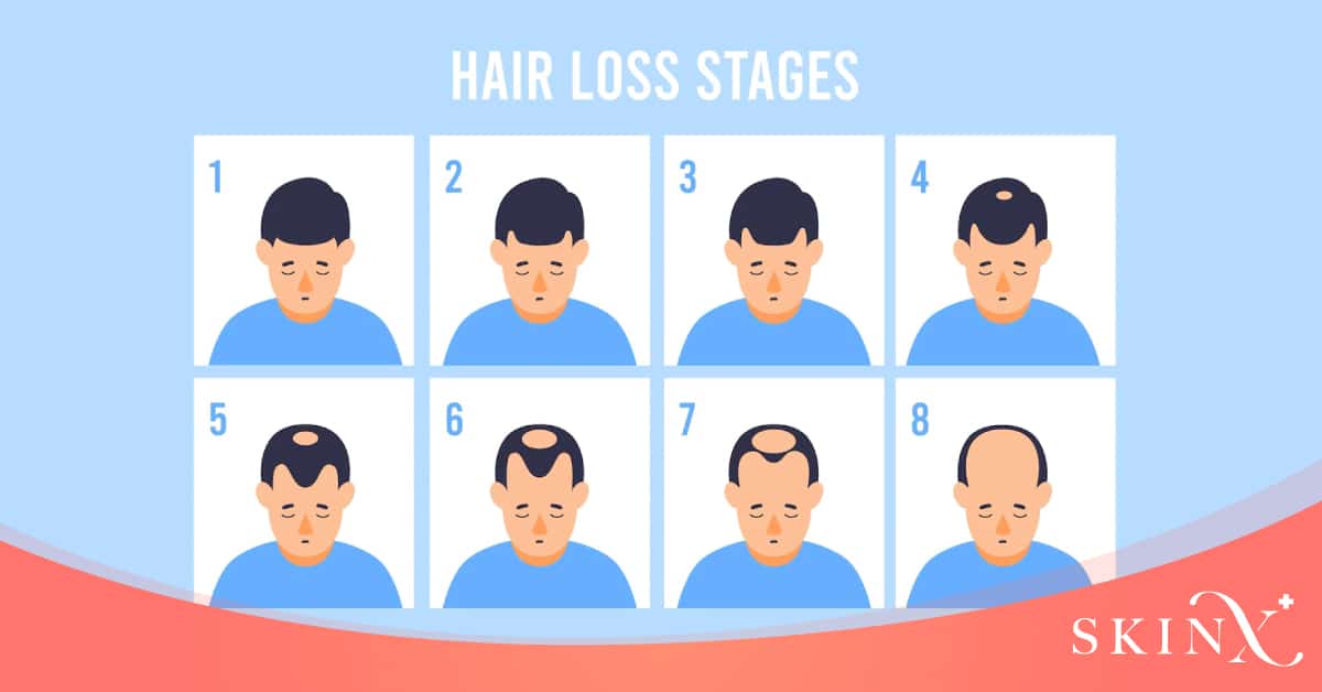 ผมร่วงเกิดจาก