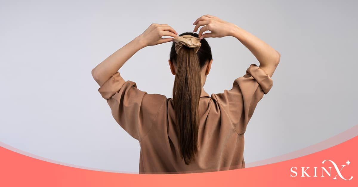 มัดผมผมร่วง