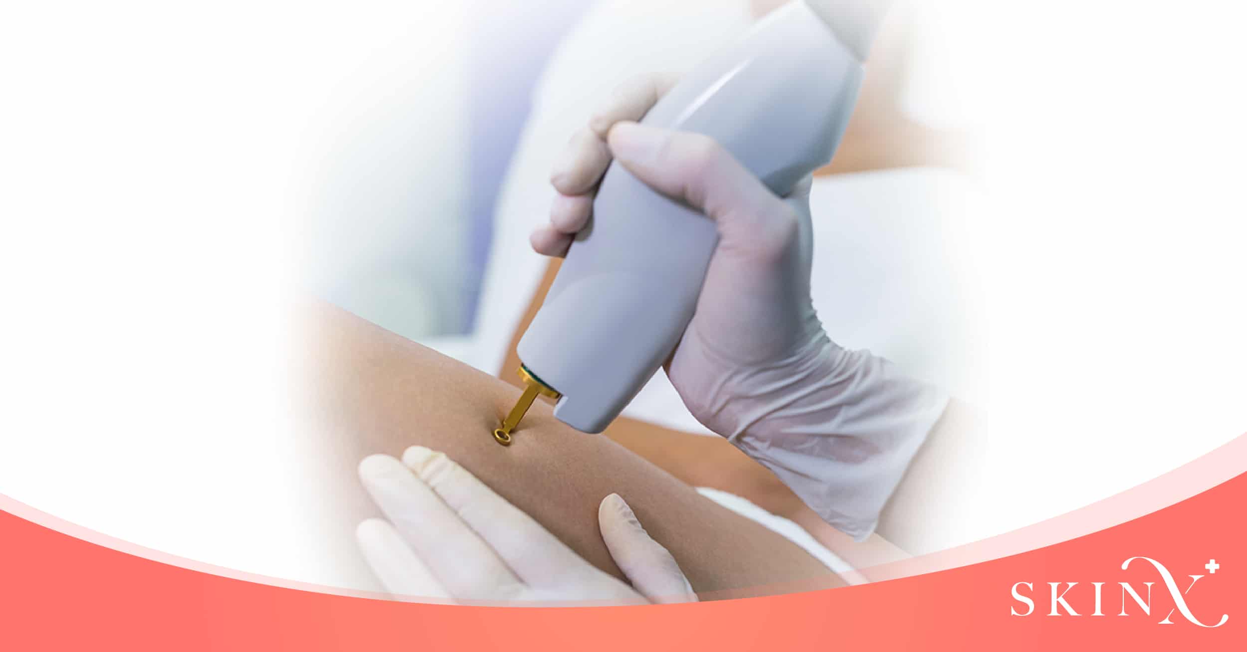 Pico Laser ทำส่วนไหนได้บ้าง