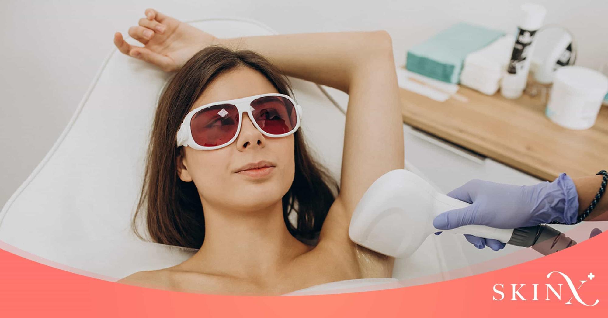 เลเซอร์กำจัดขน