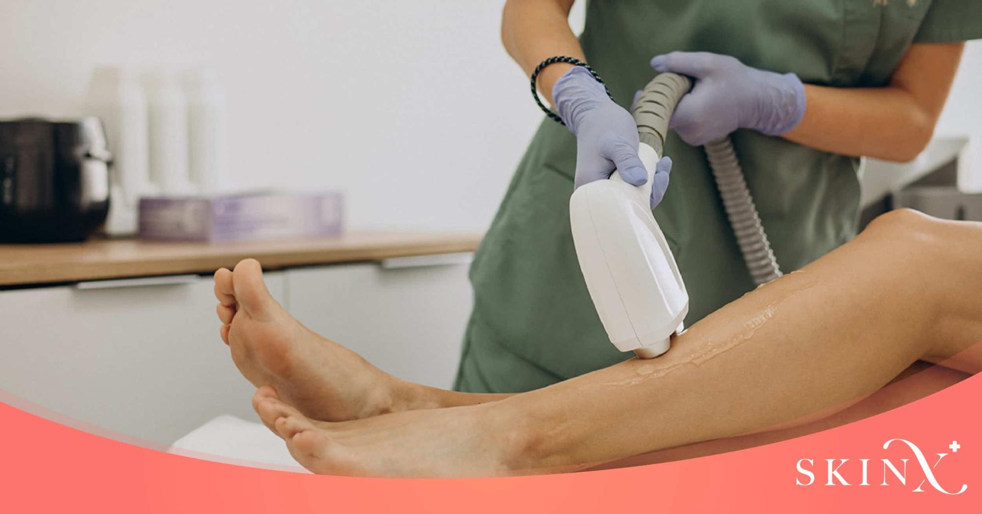 เลเซอร์ขนถาวร