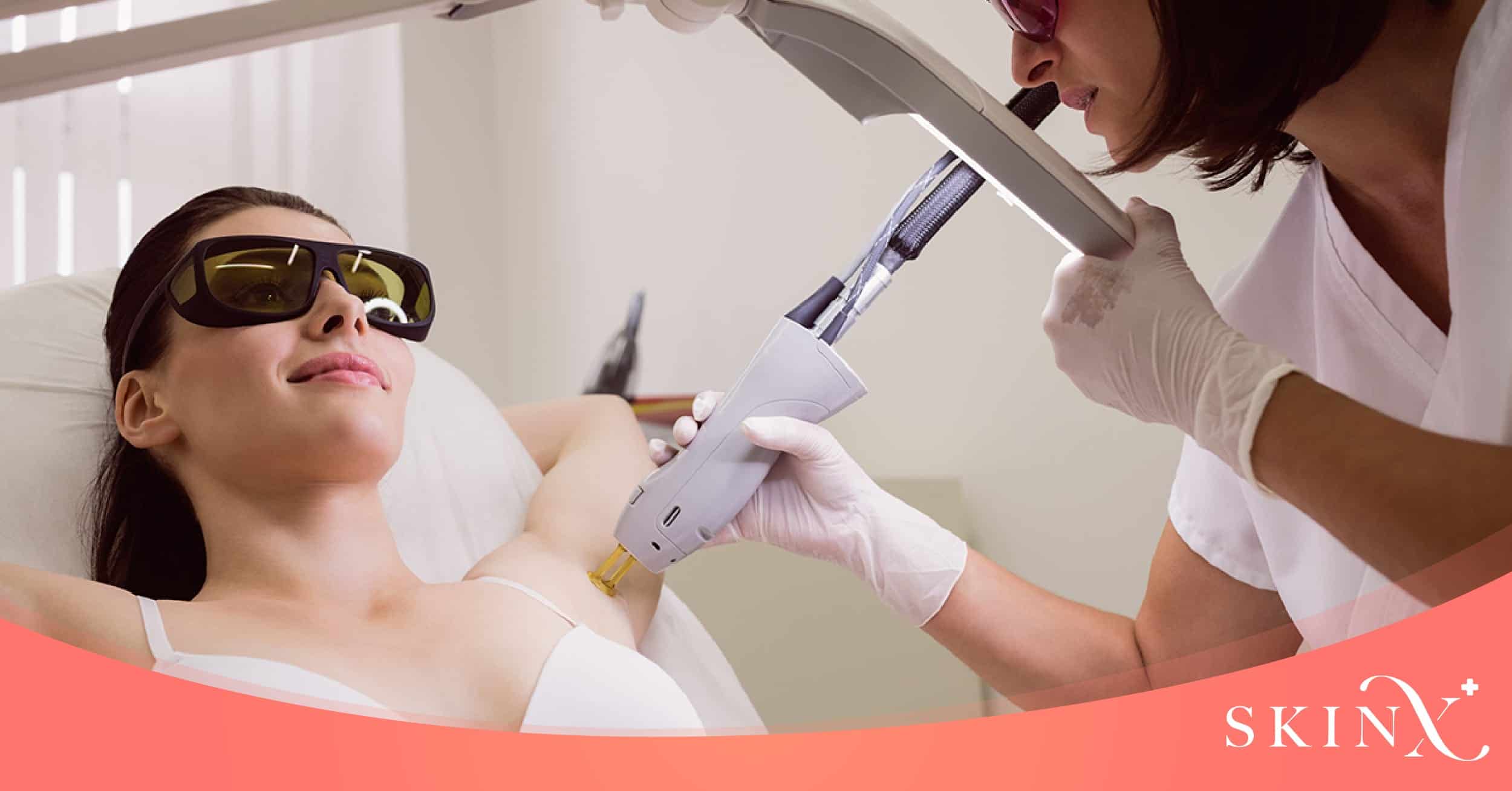 เลเซอร์รักแร้