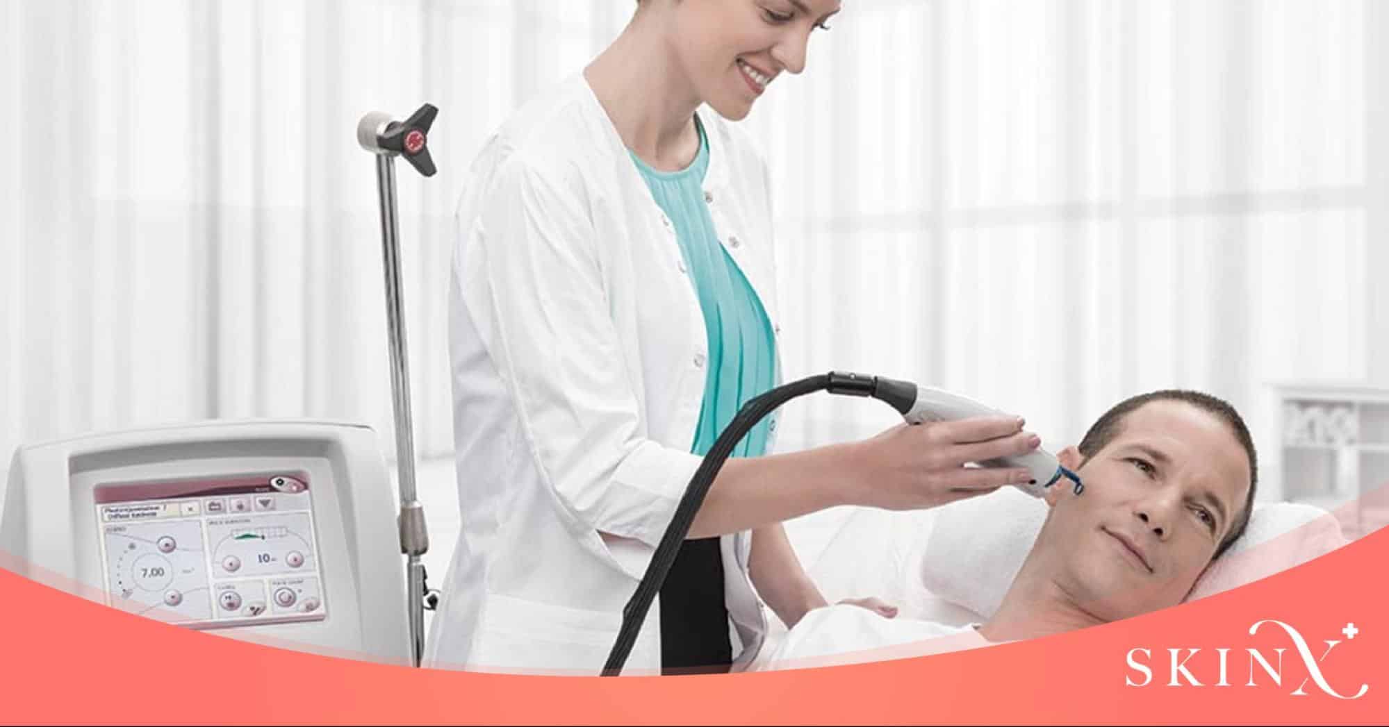 Vbeam laser คือ