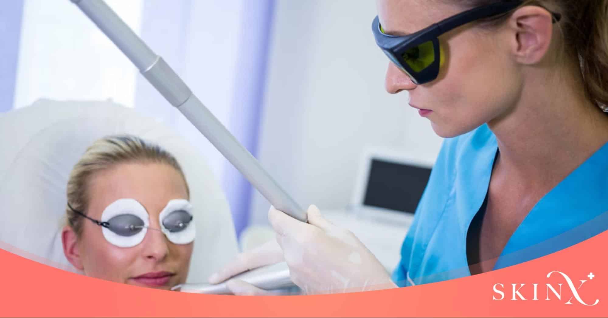 เลเซอร์ PicoWay