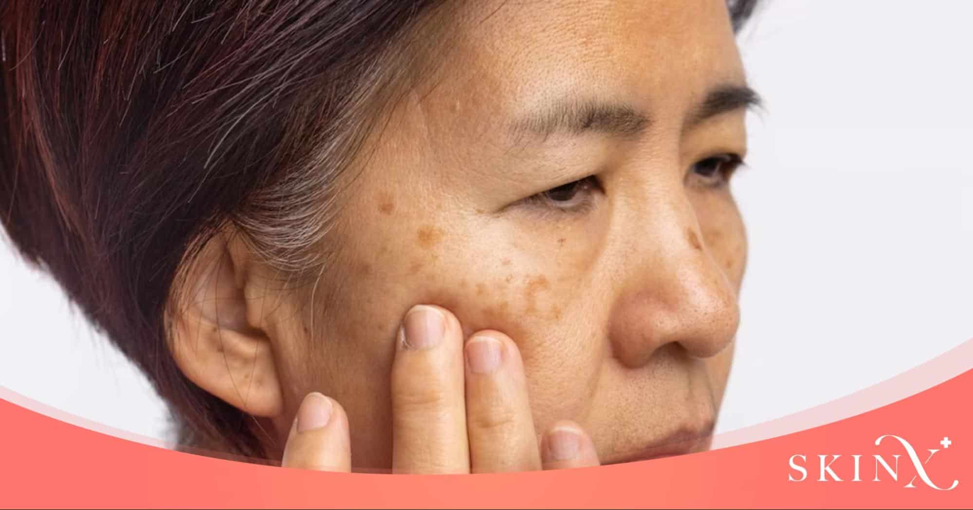 discovery pico ผลข้างเคียง