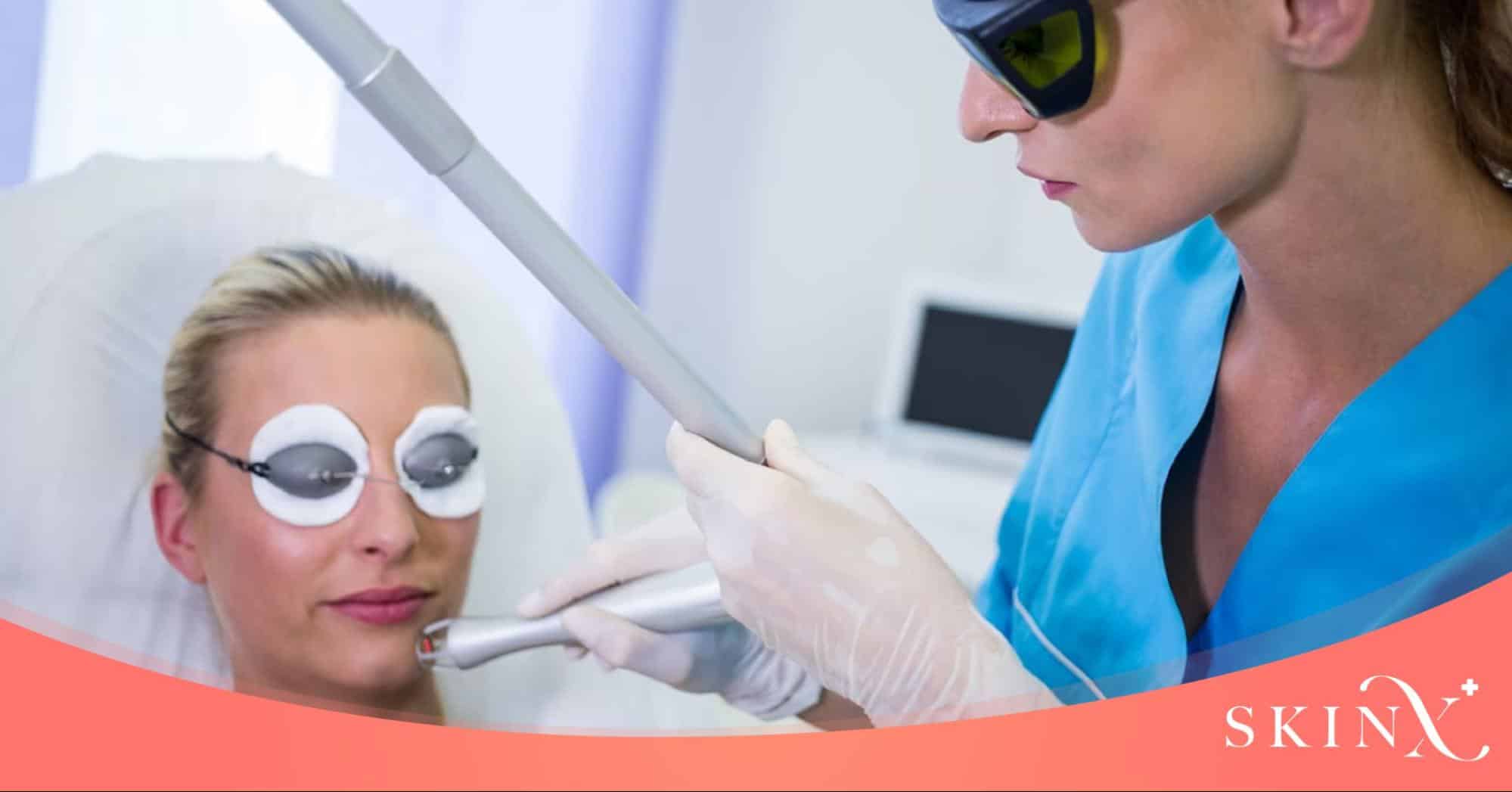 เลเซอร์ PicoSure