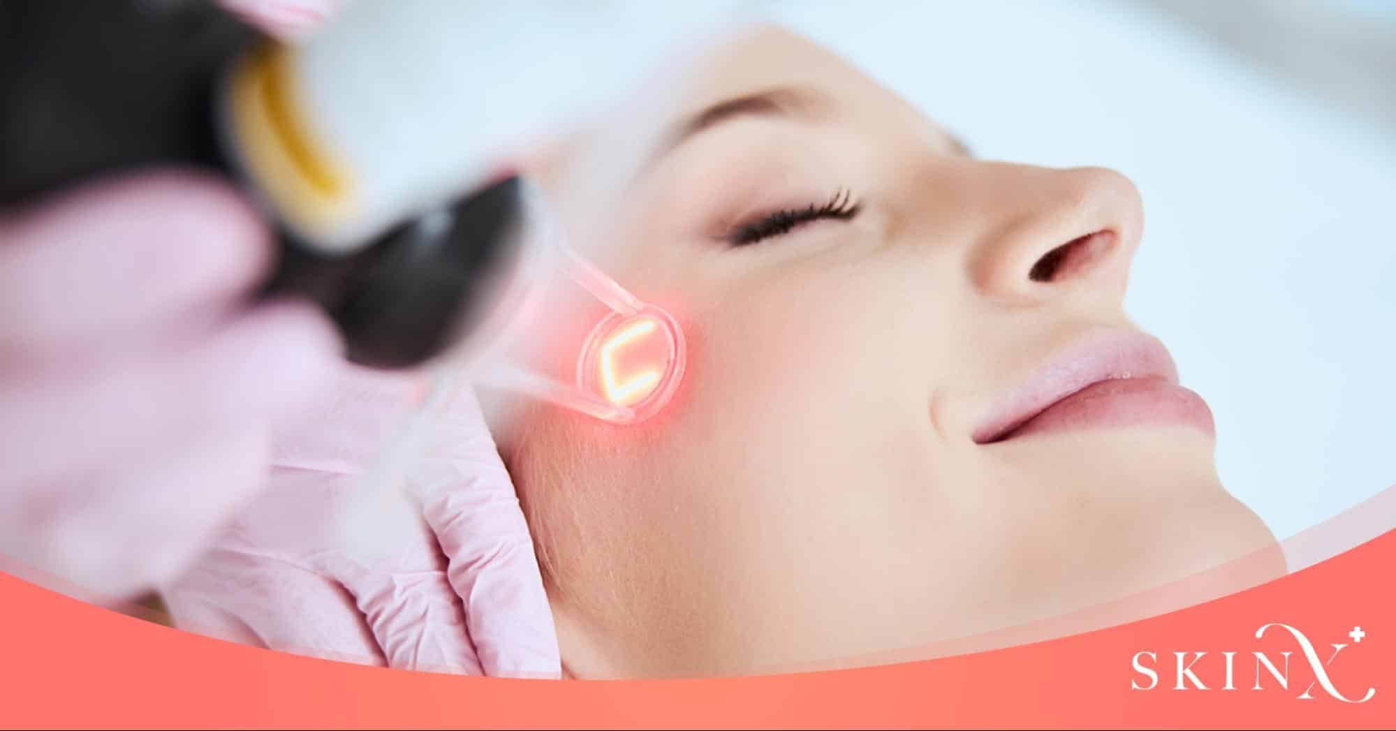 pico laser ดีไหม