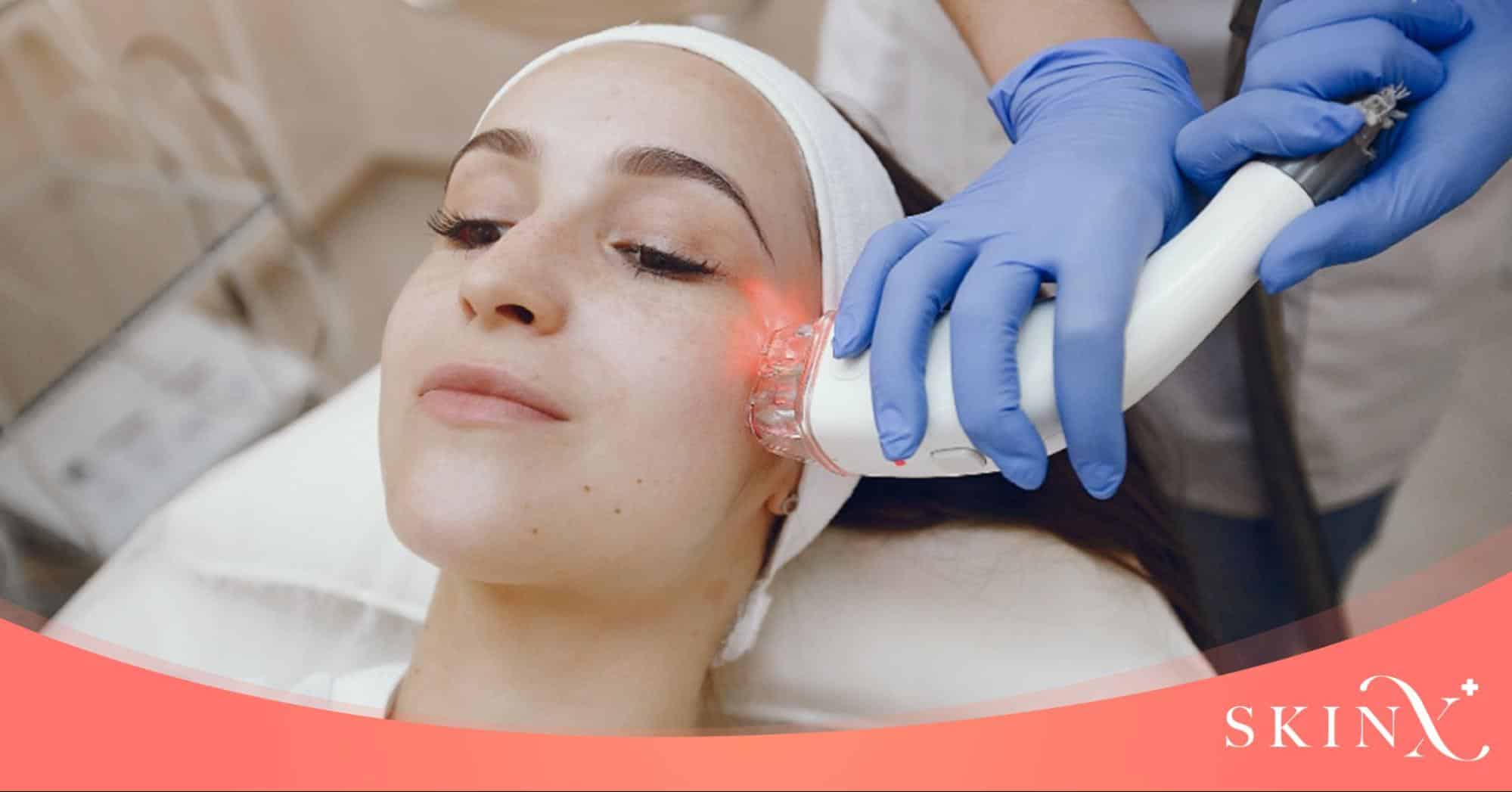 pico laser คือ