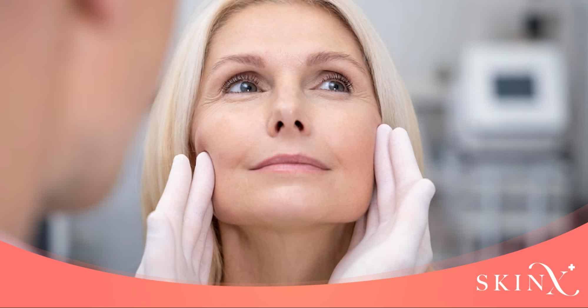 Radio Frequency คือ