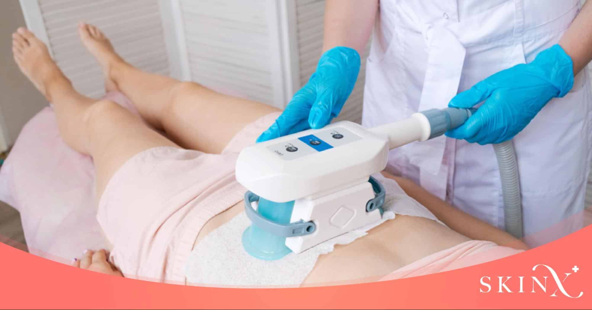 หลักการทำงานของ CoolSculpting