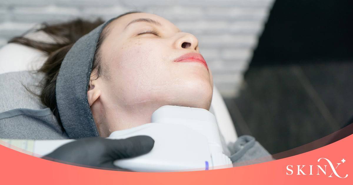 ขั้นตอนทำ hifu