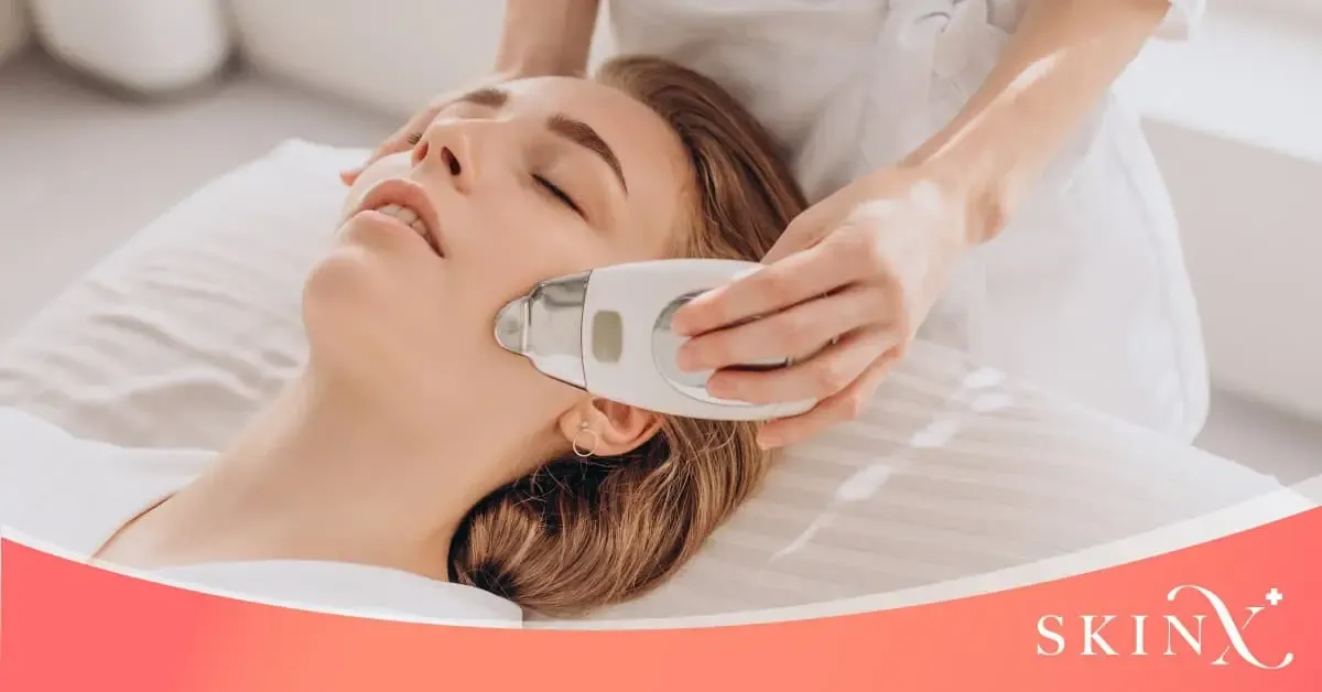 วิธีลดสิว