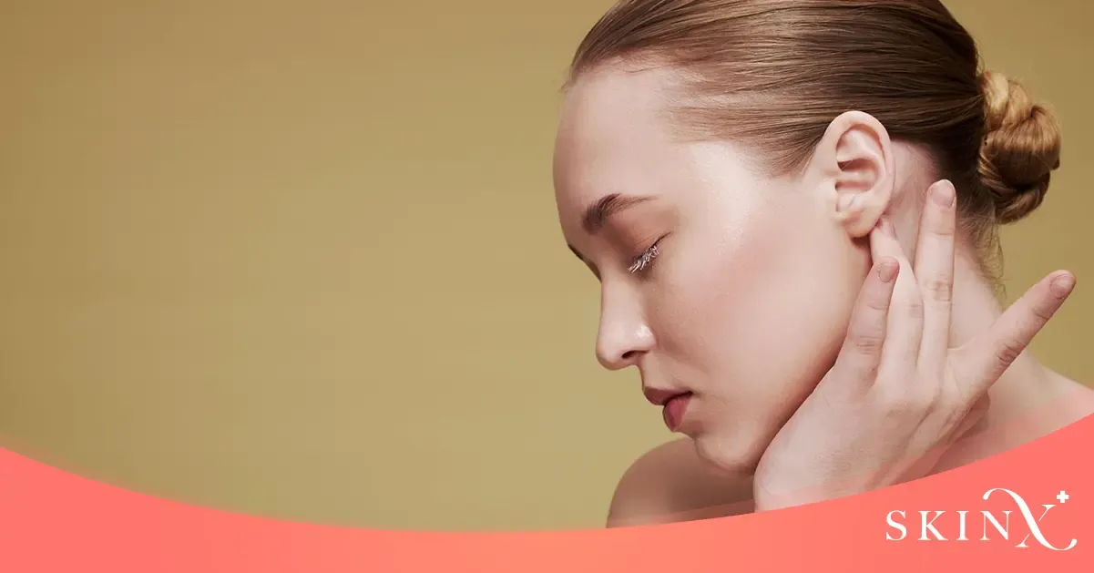 สิวที่หูเกิดจาก