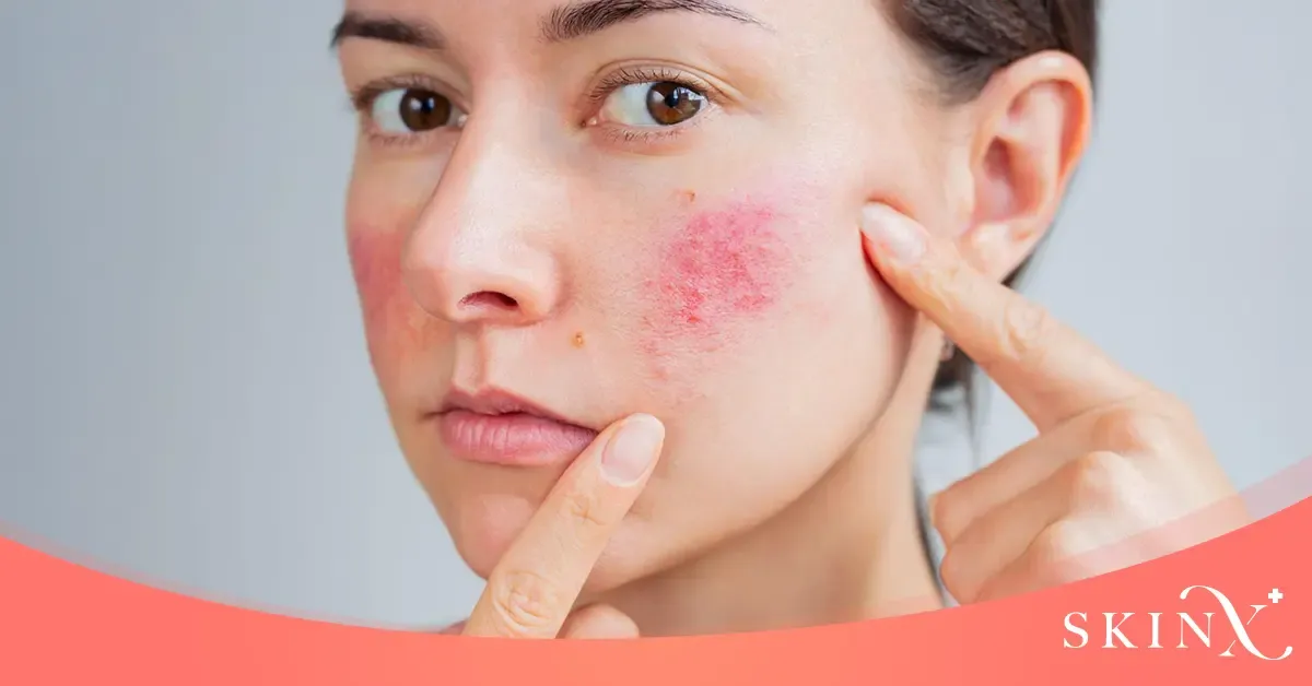 ใช้ครีมกี่วันถึงจะรู้ว่าแพ้