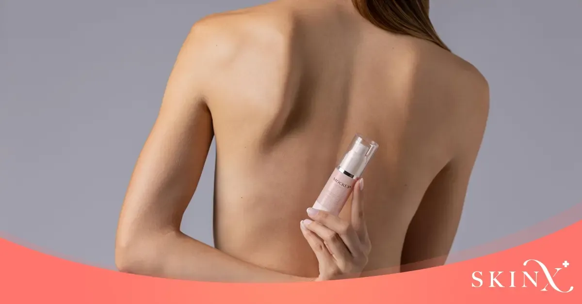 เลเซอร์สิวที่หลัง