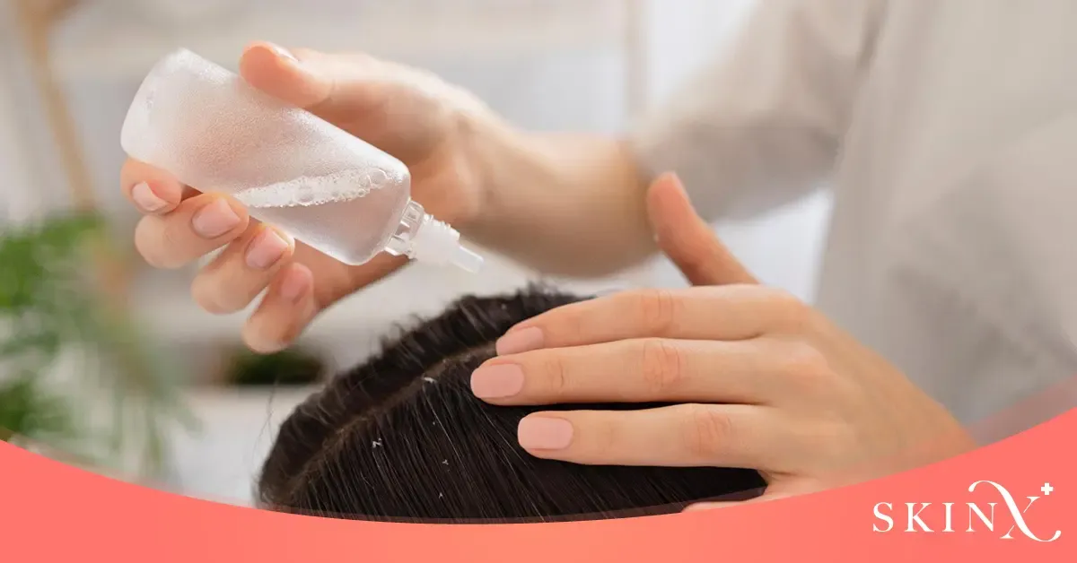 วิธีรักษาแพ้ยาสระผม