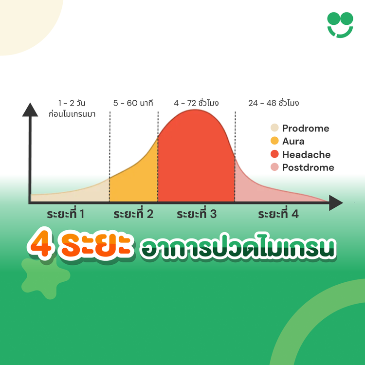 4 ระยะของโรคไมเกรนและวิธีรับมือ 