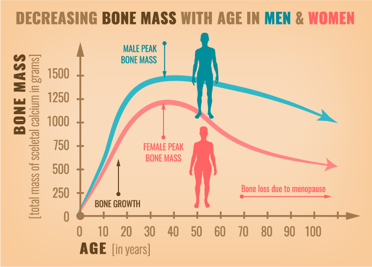 Bone Density Scale Chart