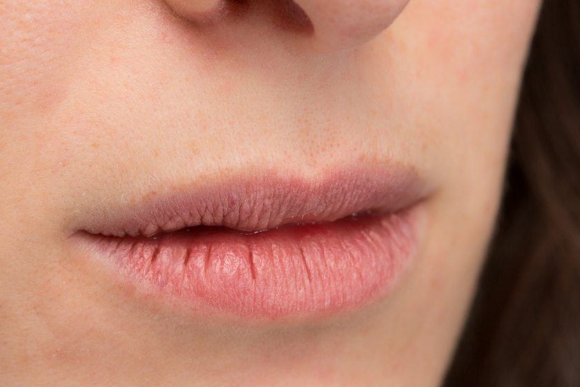 what does dry lips say about your health