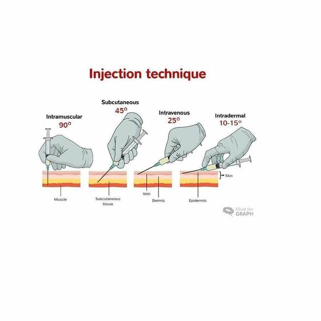 techniques of injections
#injection #medical #medicinestudent #medicalhealth #medicalcollege #medicohubworldwide #keepgoing #doctorslife #doctorsofinstagram #instagood #influencerswanted #usmle #plab #neetpg #healthcareworkers #housejobdiaries #healthylifestyle #study #studywithrija #stethoscope #bloggersofinstagram #trending #liftingeachotherup🙌 #motivation #hardworkpaysoffs