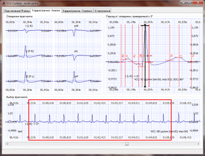 ECG Control 3.20