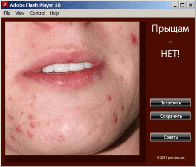 Прыщам - нет! last Прыщам - нет! last