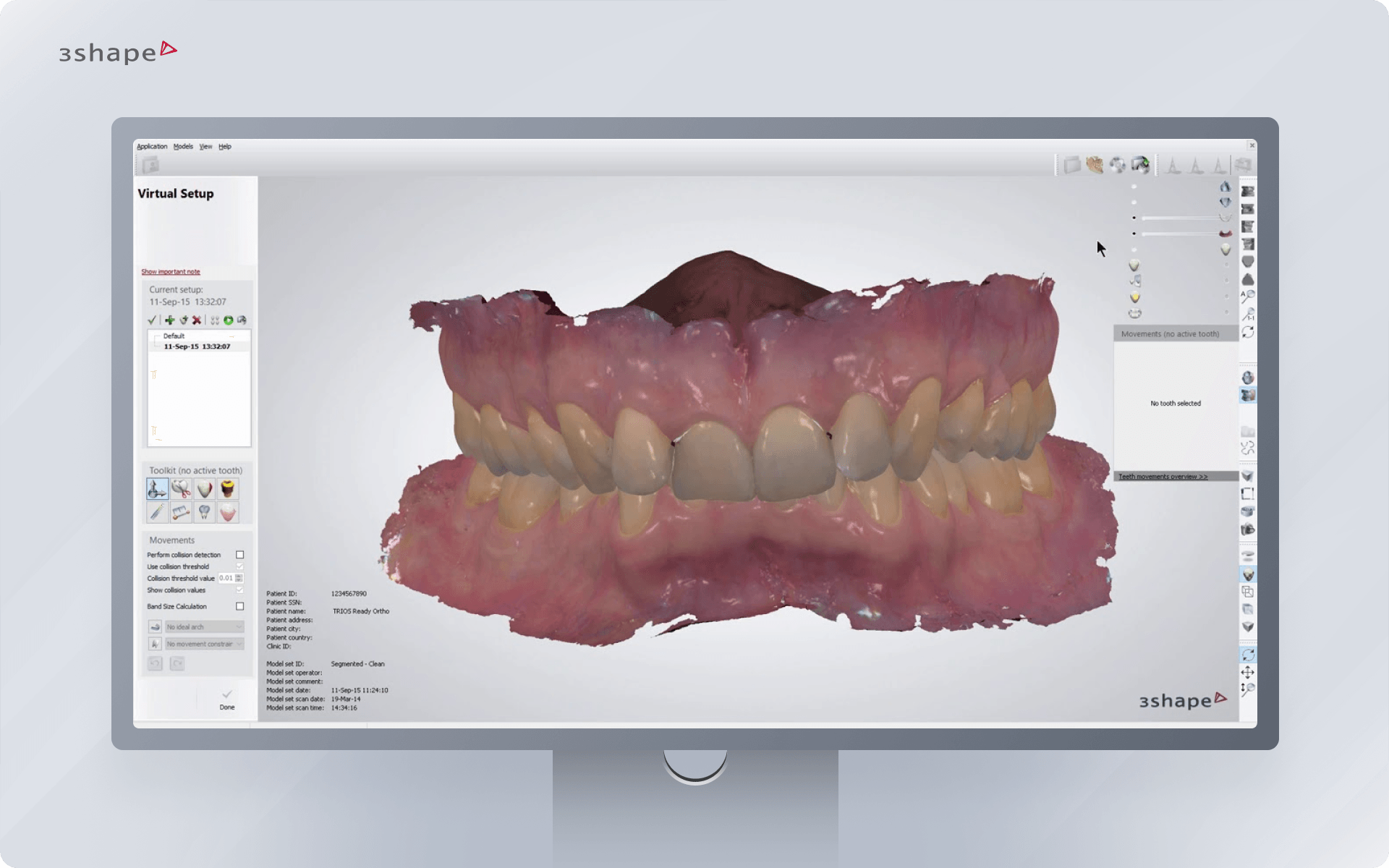 3Shape Ortho System