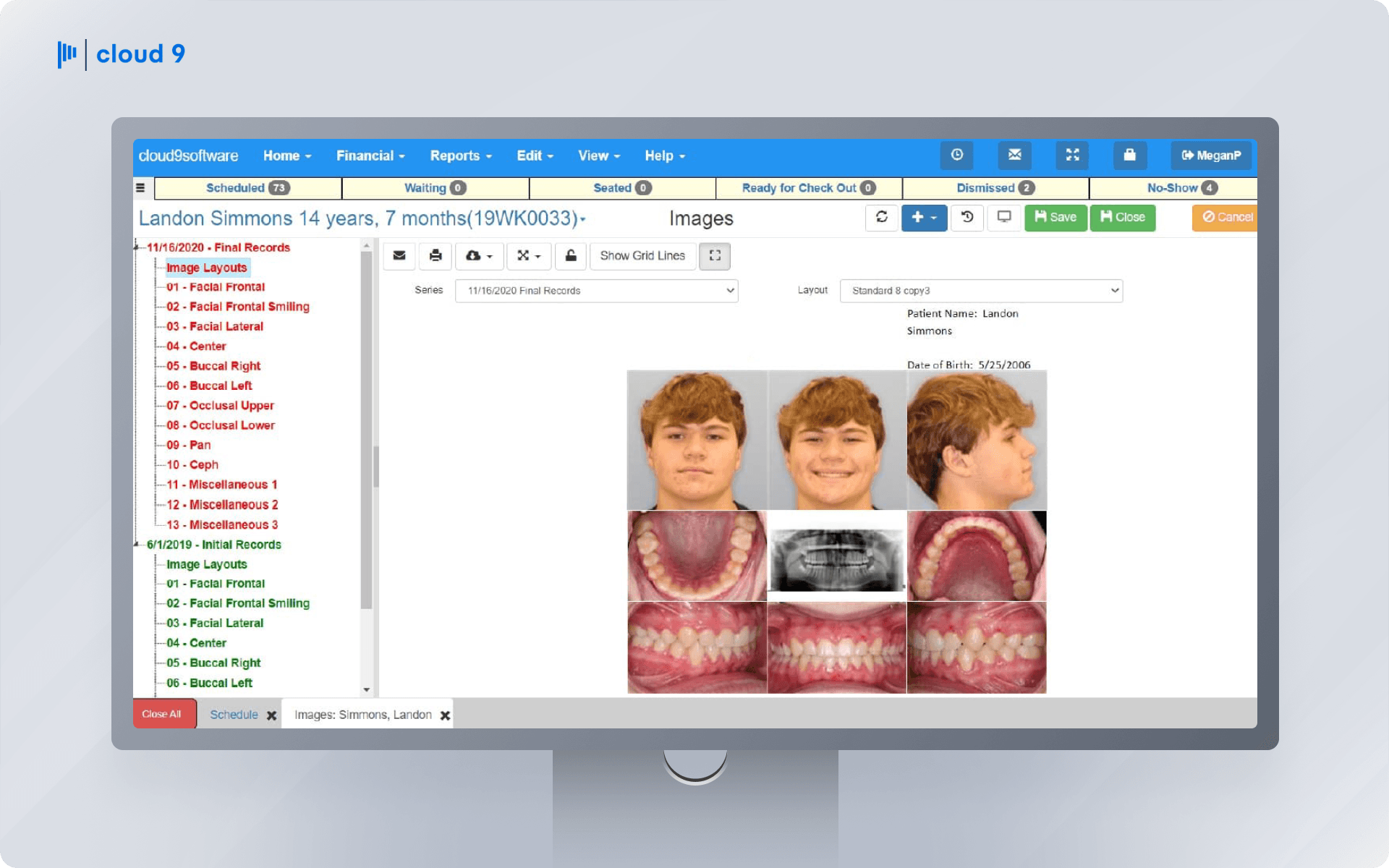 Cloud 9 Orthodontic Software