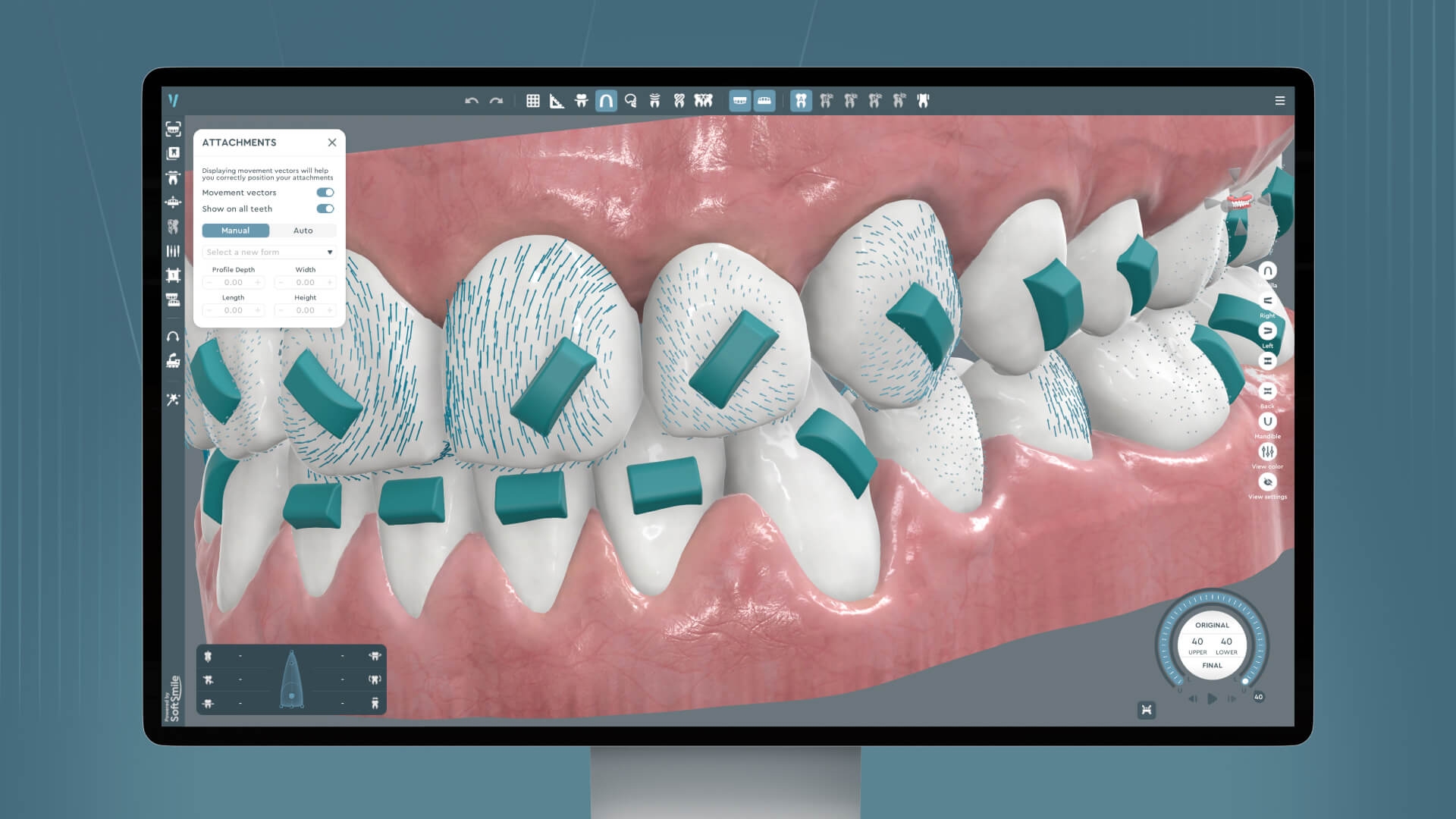 Attachments and auxiliaries for clear aligner therapy including elastics and bite ramps
