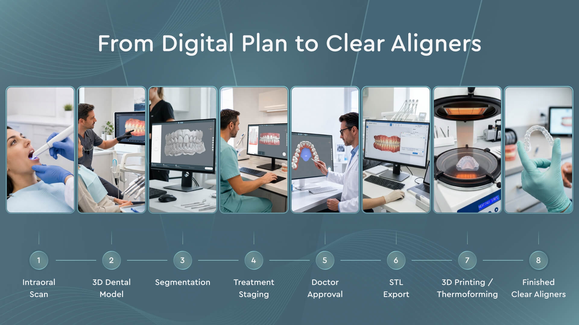 From scan to aligners workflow showing digital treatment planning and production process