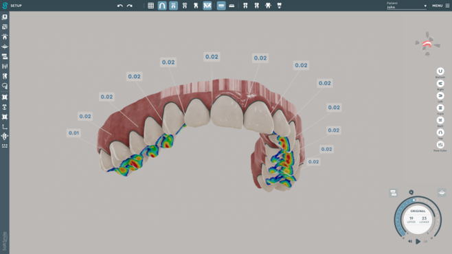 3D Aligner Design Software