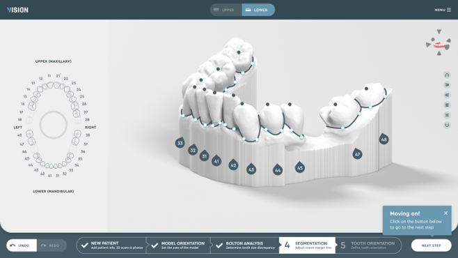 What is a dental treatment plan in digital dentistry?