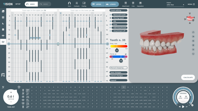 digital dental treatment planning