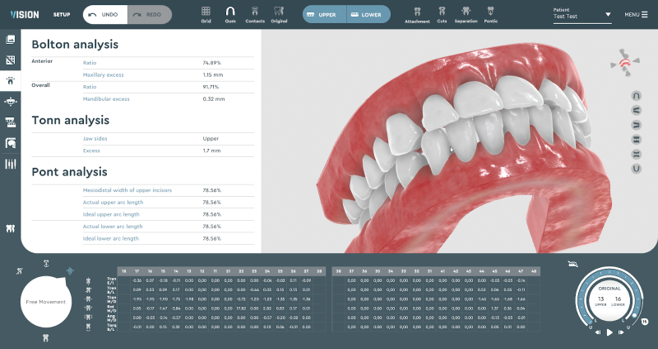 digital dental treatment planning