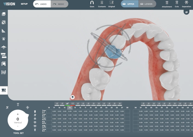 best affordable orthodontic treatment