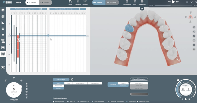 best affordable orthodontic treatment