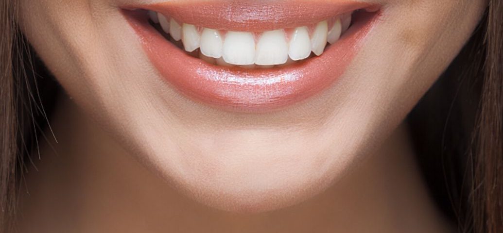 Will My HSA Cover My Dental Veneers Sola Dental Spa