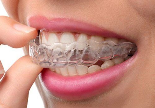 What is Included in Orthodontic Treatment?